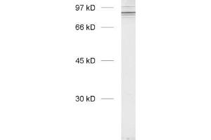 Western Blotting (WB) image for anti-Cortactin (CTTN) (N-Term) antibody (ABIN1742565) (Cortactin anticorps  (N-Term))