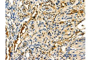 ABIN6261239 and ABIN6276806 at 1/100 staining Mouse ovarian tissue by IHC-P. (Decorin anticorps  (Internal Region))