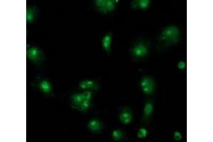 Anti-CDCP1 mouse monoclonal antibody (ABIN2454040) immunofluorescent staining of COS7 cells transiently transfected by pCMV6-ENTRY CDCP1 (RC220633). (CDCP1 anticorps)