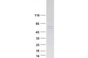 Validation with Western Blot