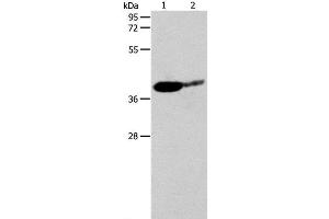 Western Blot analysis of Mouse brain and Human liver cancer tissue using SIRT3 Polyclonal Antibody at dilution of 1:500