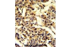 Immunohistochemistry (IHC) image for anti-Cytochrome P450, Family 2, Subfamily A, Polypeptide 13 (CYP2A13) antibody (ABIN3003850)