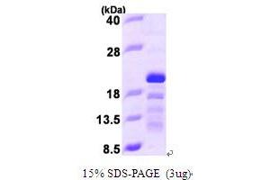 SDS-PAGE (SDS) image for Stathmin 3 (STMN3) (AA 39-180) protein (His tag) (ABIN667138)