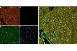 Unlabeled ATX-II successfully blocks access to NaV1.