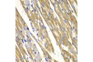 Immunohistochemistry of paraffin-embedded rat heart using TYR antibody.