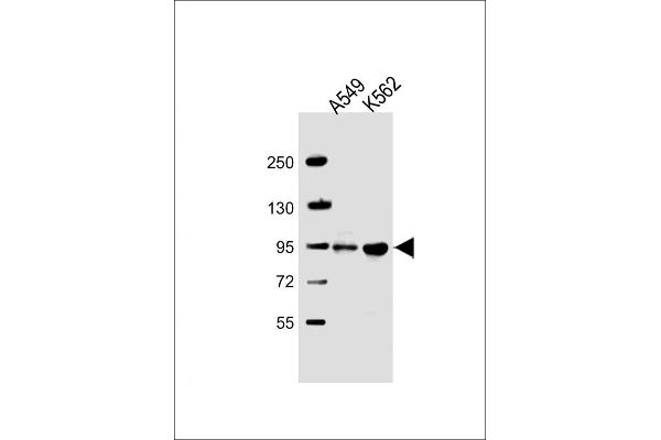 ARHGAP27 anticorps  (AA 198-226)
