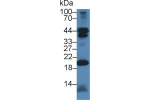 CHN2 anticorps  (AA 101-323)