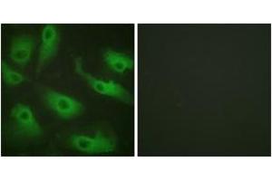 Immunofluorescence analysis of HeLa cells, using CDC37 (Ab-13) Antibody.