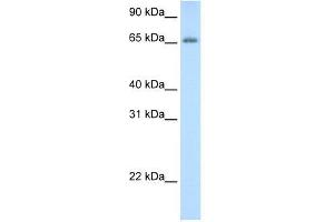 Human Thymus; WB Suggested Anti-ADAT1 Antibody Titration: 0.