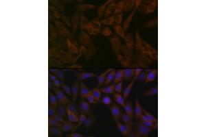 Immunofluorescence analysis of NIH-3T3 cells using  Rabbit mAb (ABIN7265484) at dilution of 1:100 (40x lens). (ARF5 anticorps)