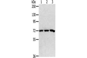 Gel: 6 % SDS-PAGE,Lysate: 40 μg,Lane 1-3: 293T cells, HepG2 cells, K562 cells,Primary antibody: ABIN7192647(SRP68 Antibody) at dilution 1/200 dilution,Secondary antibody: Goat anti rabbit IgG at 1/8000 dilution,Exposure time: 5 seconds (SRP68 anticorps)