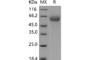 Western Blotting (WB) image for Interferon alpha/beta Receptor 1 (IFNAR1) (Active) protein (His tag) (ABIN7320266)