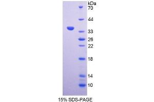 SDS-PAGE analysis of Rat AGGF1 Protein. (AGGF1 Protéine)