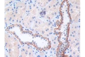 Detection of CENPI in Human Kidney Tissue using Polyclonal Antibody to Centromere Protein I (CENPI)