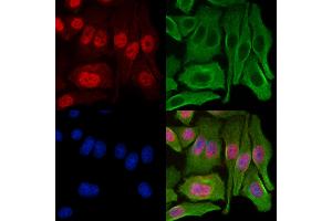 ABIN7094252 and ABIN7098299 staining Hela cells by IF/ICC. (GCHFR anticorps  (Internal Region))