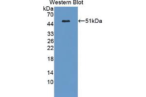 Figure. (Casein Kinase 1 delta anticorps  (AA 1-409))