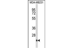 Western blot analysis of DERL2 Antibody in MDA-MB231 cell line lysates (35ug/lane) (Der1-Like Domain Family, Member 2 (DERL2) (AA 191-218), (C-Term) anticorps)