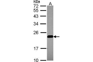 AP31081PU-N CAV2 antibody staining of A549 (A) whole cell lysate (30 µg) at 1/1000 dilution, 12% SDS PAGE. (Caveolin 2 anticorps  (AA 1-45))