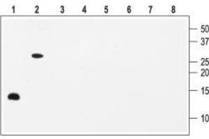 Western blot analysis with Anti-BDNF Antibody:1,5. (Brain-Derived Neurotrophic Factor (BDNF) Peptide)