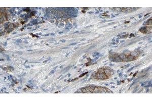 ABIN6277046 at 1/100 staining Human prostate tissue by IHC-P. (CAPZA2 anticorps  (Internal Region))