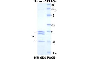 SDS-PAGE of Protein Standard from the Kit  (Highly purified E. (Catalase Kit ELISA)