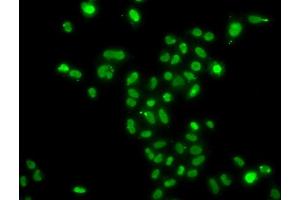 Immunofluorescence analysis of  cells using MORF4L2 antibody (ABIN6128240, ABIN6143950, ABIN6143951 and ABIN6223485).