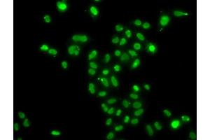 Immunofluorescence analysis of  cells using MORF4L2 antibody (ABIN6128240, ABIN6143950, ABIN6143951 and ABIN6223485). (MORF4L2 anticorps  (AA 1-100))
