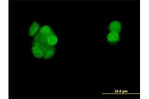 Immunofluorescence of monoclonal antibody to PGR on MCF-7 cell. (Progesterone Receptor anticorps  (AA 1-110))