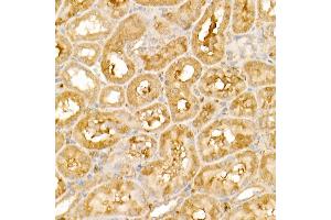 Immunohistochemistry of paraffin-embedded rat kidney using TRIM21/SS-A Rabbit pAb (ABIN6131376, ABIN6149506, ABIN6149507 and ABIN6217587) at dilution of 1:50 (40x lens). (TRIM21 anticorps  (AA 80-330))