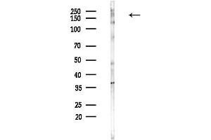 anti-Microtubule Associated serine/threonine Kinase 2 (MAST2) (Internal Region) antibody