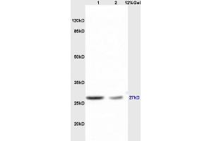 Lane 1: mouse brain lysates Lane 2: mouse liver lysates probed with Anti RPS6Polyclonal Antibody, Unconjugated (ABIN700885) at 1:200 in 4 °C.