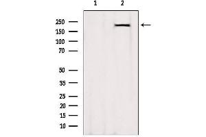 Western blot analysis of extracts from Rat heart, using MYH7-specific Antibody.