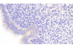 Detection of PEDF in Mouse Uterus Tissue using Polyclonal Antibody to Pigment Epithelium Derived Factor (PEDF)