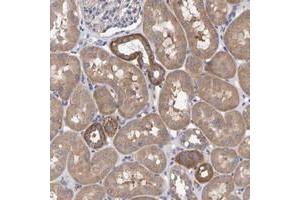 Immunohistochemical staining of human kidney with EFR3A polyclonal antibody  shows cytoplasmic positivity in tubular cells at 1:50-1:200 dilution. (EFR3A anticorps)