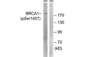 Western blot analysis of extracts from 293 cells treated with epo 20U/ml 15', using BRCA1 (Phospho-Ser1457) Antibody. (BRCA1 anticorps  (pSer1457))