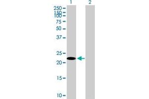Western Blot analysis of TSC22D3 expression in transfected 293T cell line by TSC22D3 MaxPab polyclonal antibody. (TSC22D3 anticorps  (AA 1-200))