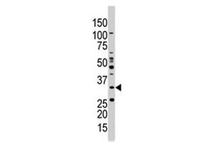 The PRKAB1 polyclonal antibody  is used in Western blot to detect PRKAB1 in Jurkat cell lysate . (PRKAB1 anticorps  (N-Term))