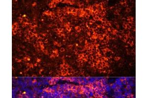 Immunofluorescence analysis of Mouse spleen using TLR8 Polyclonal Antibody at dilution of 1:100 (40x lens). (TLR8 anticorps)