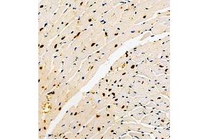 Immunohistochemistry of paraffin embedded mouse heart using DEPDC1 (ABIN7073717) at dilution of 1:500 (300x lens)