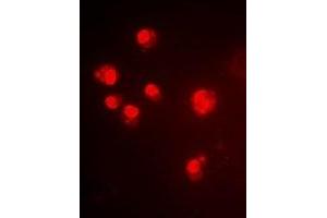 Immunofluorescent analysis of ALG-2 staining in Hela cells.