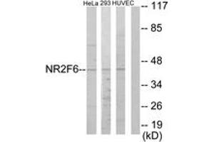 Western Blotting (WB) image for anti-Nuclear Receptor Subfamily 2, Group F, Member 6 (NR2F6) (AA 11-60) antibody (ABIN2889389)
