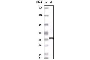 Western blot analysis using calcyclin mouse mAb against truncated calcyclin recombinant protein. (S100A6 anticorps)