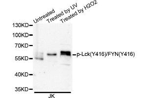 Western blot analysis of extracts of Jurkat cells, using Phospho-Lck-Y416/FYN-Y416 antibody.