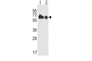 Western Blotting (WB) image for anti-Solute Carrier Family 3 (Activators of Dibasic and Neutral Amino Acid Transport), Member 2 (SLC3A2) antibody (ABIN2995541) (SLC3A2 anticorps)