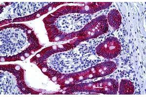 Human Intestine: Formalin-Fixed, Paraffin-Embedded (FFPE) (Keratin Basic anticorps)