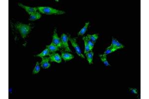 anti-Tribbles Pseudokinase 2 (TRIB2) (AA 204-337) antibody