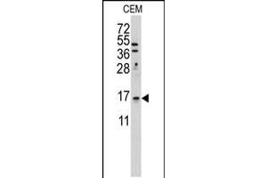 Western blot analysis of anti-LSM1 Antibody in Hela cell line lysates (35ug/lane) (LSM1 anticorps  (C-Term))