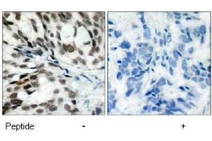 Image no. 1 for anti-Retinoblastoma 1 (RB1) (Ser780) antibody (ABIN197285) (Retinoblastoma 1 anticorps  (Ser780))