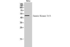 Western Blotting (WB) image for anti-Casein Kinase 1, gamma 2 (CSNK1G2) (N-Term) antibody (ABIN3183661) (Casein Kinase 1 gamma 2 anticorps  (N-Term))
