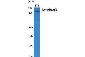 Western Blot (WB) analysis of specific cells using Actinin-alpha3 Polyclonal Antibody.